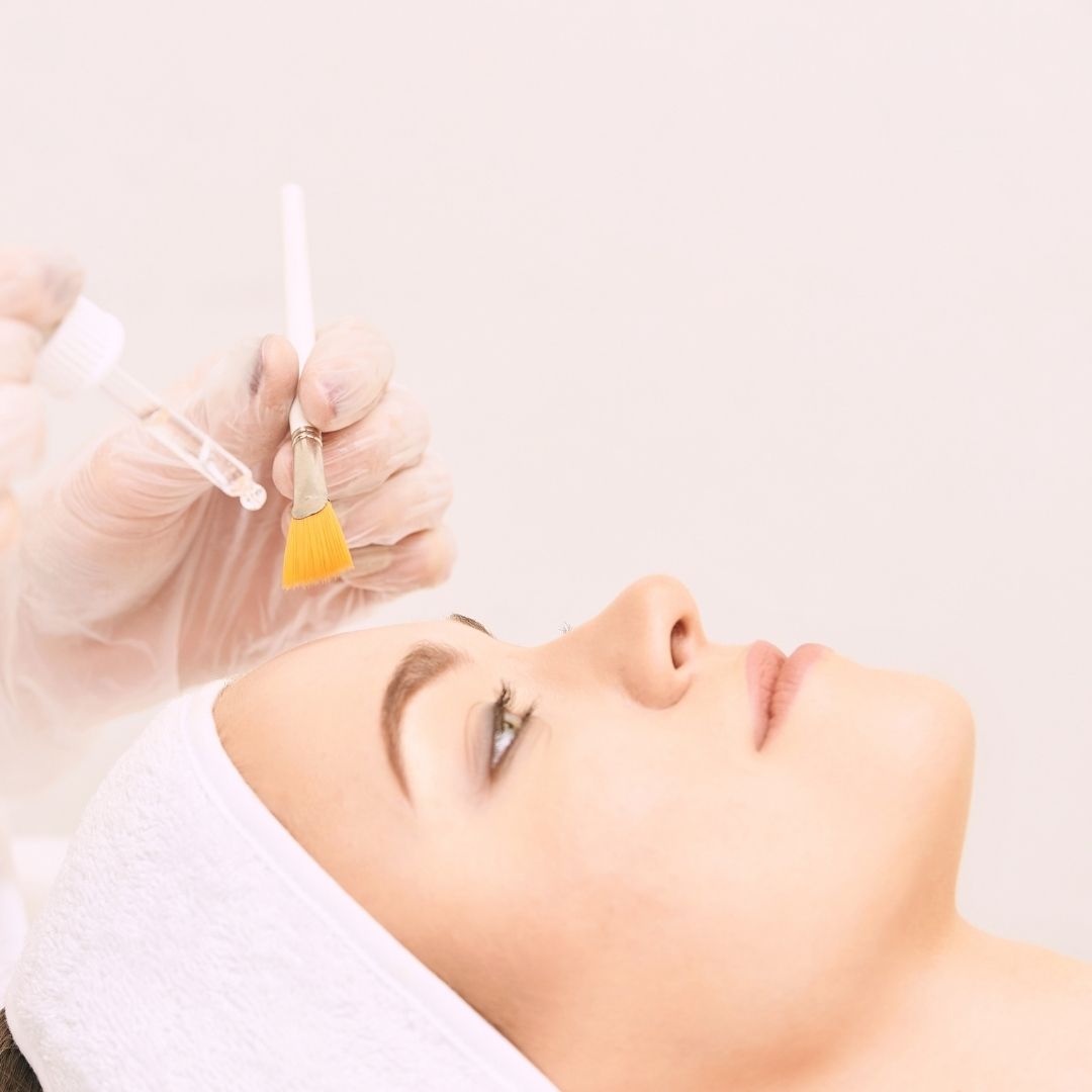 Chemical peel