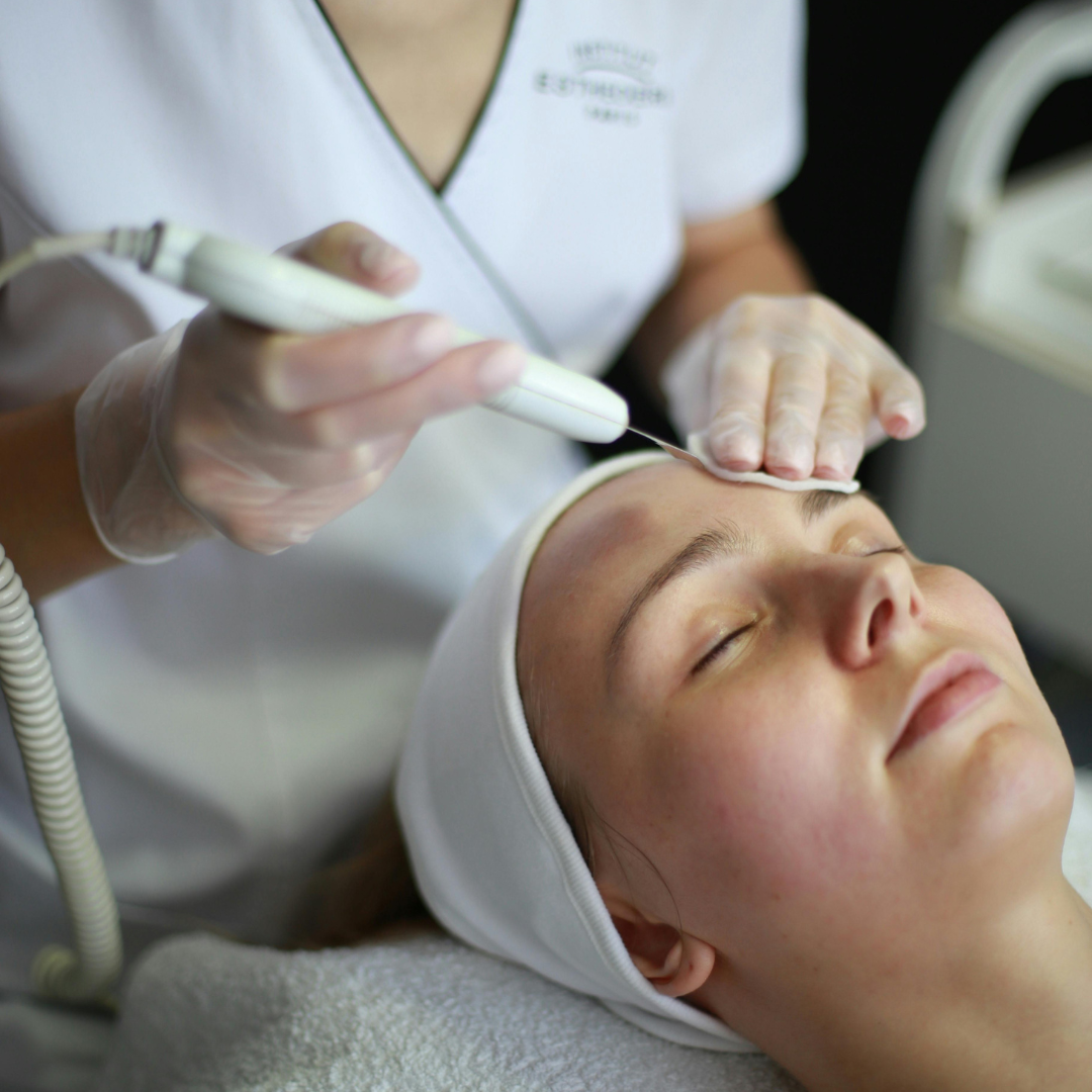 Microdermabrasion
